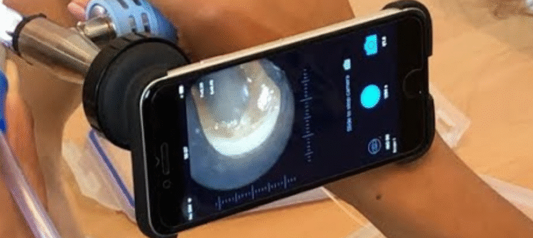 Why Professional Earwax Removal is Safer Than DIY Methods